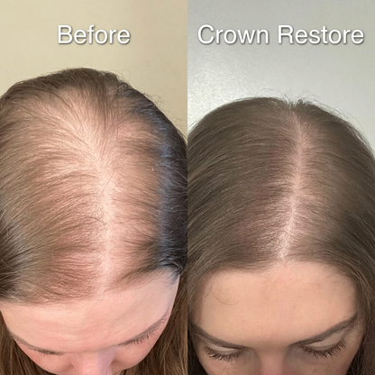 Luma Labs Crown Restore