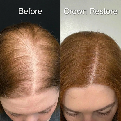 Luma Labs Crown Restore