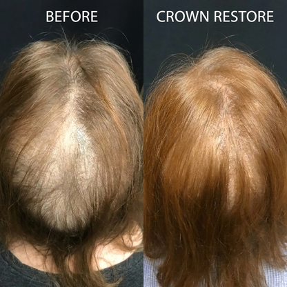 Luma Labs Crown Restore