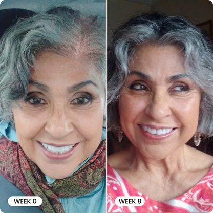 Luma Labs Crown Restore