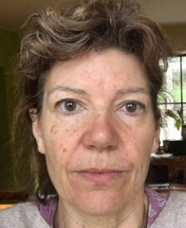 files/woman_after.png